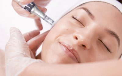 Micro Needling 2